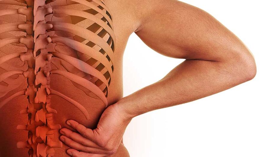 Osteochondrosis of the lumbar spine