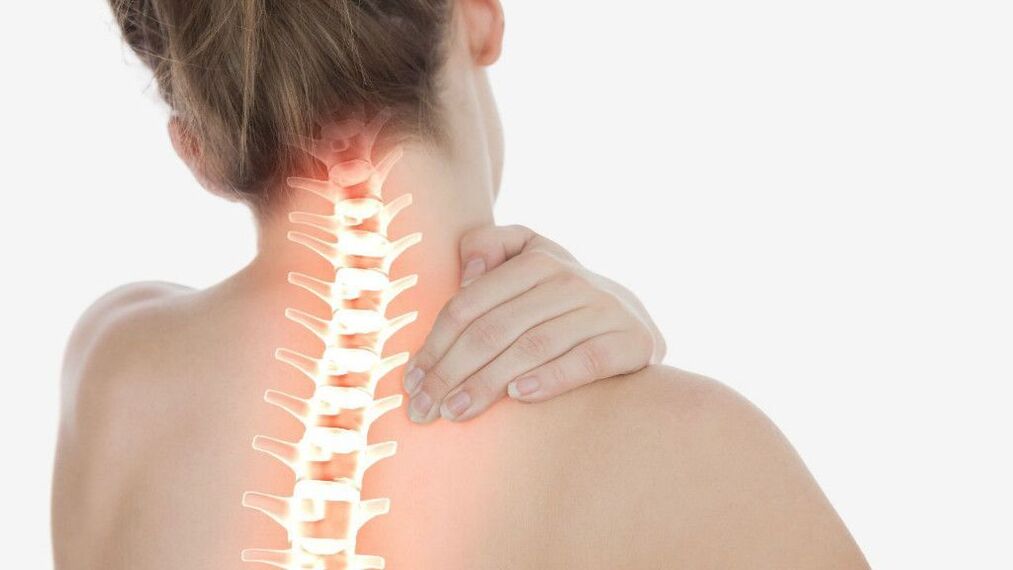 Neck pain due to osteochondrosis of the cervical spine